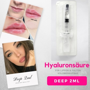 Hyaluronsure Lippen 2ml DEEP Fertigspritze Falten & Lippenvolumen 2 ml Hyaluron Pen geeignet CE